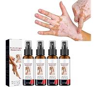 DUBUSH Spray lenitivo alla vitiligine da 30 ml, Spray per la Riparazione della Pelle alla vitiligine, Spray per la Cura della vitiligine per la Cura della Pelle, Riduce Le Macchie Bianche sulla Pelle