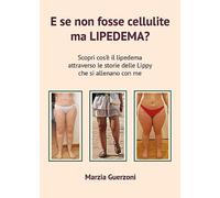 E se non fosse cellulite ma lipedema? - Guerzoni Marzia