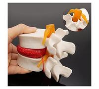 EAnatomical Models Anatomia Umana Scheletro Spina Lombare Disco Ernia Modello di insegnamento Cervello Cranio Traumatico Pistola Forniture scolastiche Instrume