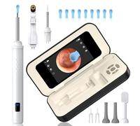 Earglow Pulizia Orecchie - Schermo da 3.97", Nessun Download di App Necessario | Rimozione Cera/Spillo Puntini, Aiuto Cura Orale | Montaggio Magnetico, Custodia Ricaricabile | Per Famiglia & Viaggi