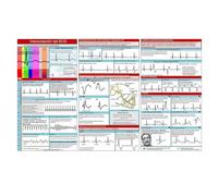 ECG Pocket Guide, 30 x 15,91 cm Ecg Interpretazione Pocket Card, Grafico Aritmia, Doppio Layout Facile Lettura, Guida di Riferimento ECG completa per Ospedale Casa Scuola Uso