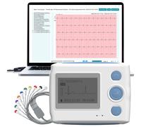 ECG Portatile 12 Derivazioni Holter Cardiaco 24 ore con Rapporto di Analisi AI