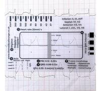ECG - Righello a 7 gradini, in plastica, strumento di misurazione per interpretazione ECG/ECG, strumento di misurazione trasparente, strumento di misurazione per studenti di medicina infermieristica