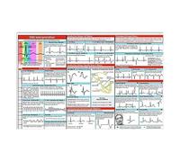 Ecg Ruler | Poster guida per la conoscenza 'interpretazione ECG | Cartolina tascabile ECG UK per l'interpretazione ECG/ECG, ideale per studenti, paramedici, EMT, infermieri e