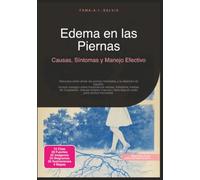 Edema en las Piernas: Causas, Síntomas y Manejo Efectivo