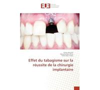Effet du tabagisme sur la réussite de la chirurgie implantaire