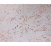EFFETTO DECORATIVO A TAMPONE MAX MEYER VANITY LT. 1 RAME ORO ARGENTO