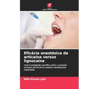 Eficácia anestésica da articaína versus lignocaína: Uma investigação científica sobre a remoção cirúrgica de terceiros molares mandibulares impactados