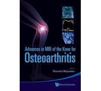 Ehsan Saadat Advances In Mri Of The Knee For Osteoarthritis (Copertina rigida)