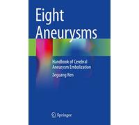 Eight Aneurysms: Handbook of Cerebral Aneurysm Embolization