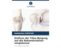 Einfluss der Tibia-Neigung auf die Rekonstruktion-sergebnisse: von Vorderes Kreuzband