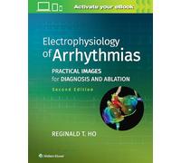 Electrophysiology of Arrhythmias: Practical Images for Diagnosis and Ablation