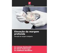 Elevação da margem profunda: Elevação de margem inteligente