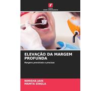 ELEVAÇÃO DA MARGEM PROFUNDA: Margens previsíveis e precisas