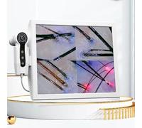 ELIKBH Telecamera per Il Cuoio capelluto da 15 Pollici per saloni di Bellezza - Pixel da 1000 W, rilevatore di umidità dell'olio del follicolo pilifero con Schermo LCD e Alimentazione a 220 V