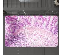 EMCLKS Tappeto Bagno 60x90 cm,Vista al microscopio di un adenonocarcinoma duttale da una sezione di tessut,Tappetino Assorbente e Antiscivolo in Microfibra per Bagno,Cucina,Camera da Letto,Corridoio