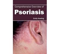 Emily Howling Comprehensive Overview of Psoriasis (Copertina rigida)