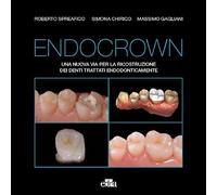 Endocrown – Una nuova via per la ricostruzione dei denti trattati endodonticamente – edra