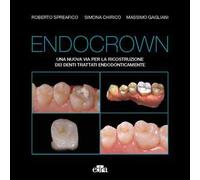 Endocrown – Una nuova via per la ricostruzione dei denti trattati endodonticamente – edra