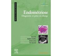 Endométriose: Diagnostic et prise en charge