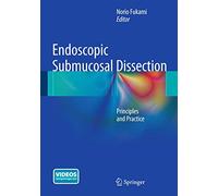 Endoscopic Submucosal Dissection: Principles and Practice