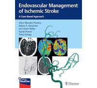 Endovascular Management of Ischemic Stroke: A Case-Based Approach
