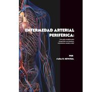 Enfermedad arterial periférica: ¡Una guía completa para comprender sus síntomas, tratamiento, manejo y más!