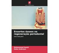 Enxertos ósseos na regeneração periodontal: Uma visão geral