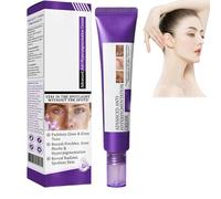 Epiglow Melanex Advanced Anti-Hyperpigmentation Cream, Dark Spot Cream, Epiglow Melanex C-ream For Hyperpigmentation Treatment, Anti-Aging Face C-ream, Dark Spot Remover For All Skin Types, 20g (1)