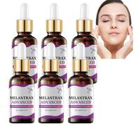 Epiglow Melanex Advanced crema anti-iperpigmentazione, correzione delle macchie scure per viso e corpo, riduzione delle lentiggini e siero idratante e schiarente (6 pezzi)