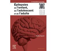 Epilepsies de l'enfant, de l'adolescent et de l'adulte: De la physiopathologie à la prise en charge
