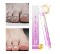 Erconsso Olio per Cuticole e Unghie - Penna Rinforzante Da 3.5ml - Oli Rivitalizzanti per Cuticole - Per Donne e Uomini Routine Quotidiana Dopo Manicure Cura Sera Mattina Salon Viaggio Cura Personale