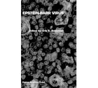 Erle S. Robertson Epstein-Barr Virus (Copertina rigida)