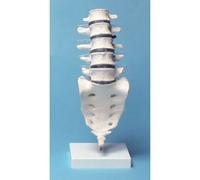 Erler Zimmer, modello anatomico di colonna vertebrale lombare, su stativo 4036