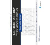 Essential Concepts of Electrophysiology Through Case Studies: Intracardiac EGMs: Intracardiac EGMs : Intracardiac EGMs