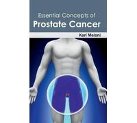 Essential Concepts of Prostate Cancer (Copertina rigida)