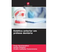 Estética anterior em prótese dentária
