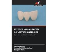 ESTETICA NELLA PROTESI IMPLANTARE ANTERIORE: Una revisione completa dei parametri estetici