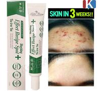 Etichetta Young Shocking Effect Ricetta Spot Tea Tree Versione 30ml Trattamen...