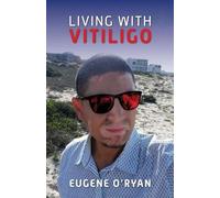 Eugene O'Ryan Living with Vitiligo (Tascabile)