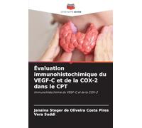 Évaluation immunohistochimique du VEGF-C et de la COX-2 dans le CPT: Immunohistochimie du VEGF-C et de la COX-2