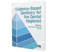 Evidence-Based Dentistry for the Dental Hygienist