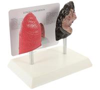 EXAOMBLE Modello Polmonare Didattico Realistico in Pvc Confronto tra Polmone e Polmone per Insegnamento di Anatomia e Fisiologia Scolastica