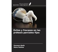Éxitos y fracasos en las prótesis parciales fijas