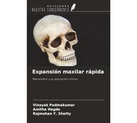 Expansión maxilar rápida: Mecanismo y su aplicación clínica