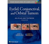 Eyelid, Conjunctival, and Orbital Tumors: An Atlas and Textbook