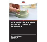 Fabrication de prothèses partielles coulées en laboratoire