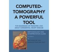 Facc Shakibi Computed-Tomography a Powerful Tool for Diagnosis of Pe (Tascabile)