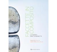 Faccette in composito. La tecnica diretta-indiretta