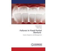 Failures in Fixed Partial Denture: Causes, Diagnosis, and Management